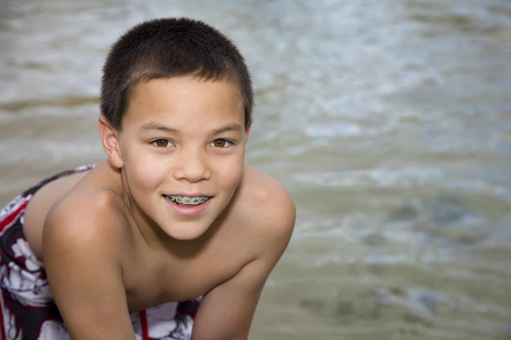 Early Orthodontic Treatment Bundoora