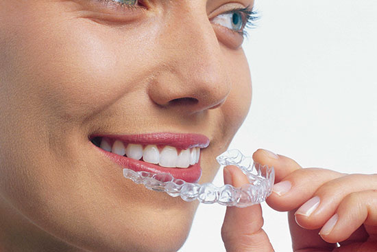 Bundoora Invisalign Go