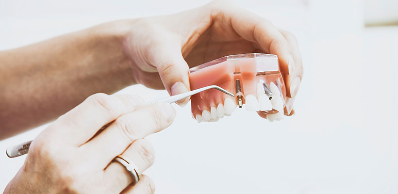 best dental implants bundoora
