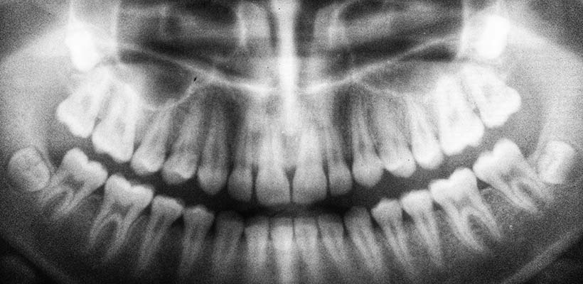 your-teeth-dentist-bundoora